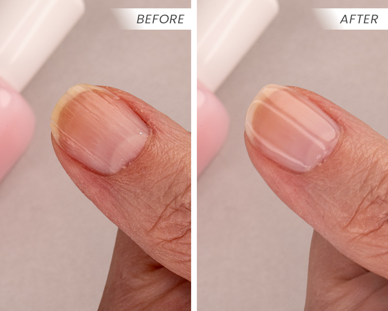 Pure Perfector Before & After 1 Pure Perfector Before & After 1