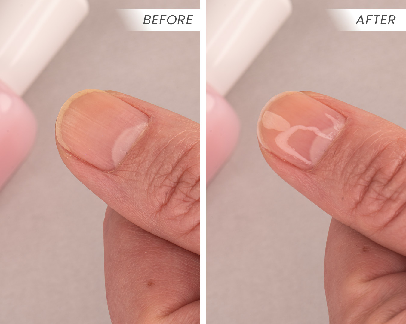 Pure Perfector Before & After 4 Pure Perfector Before & After 4