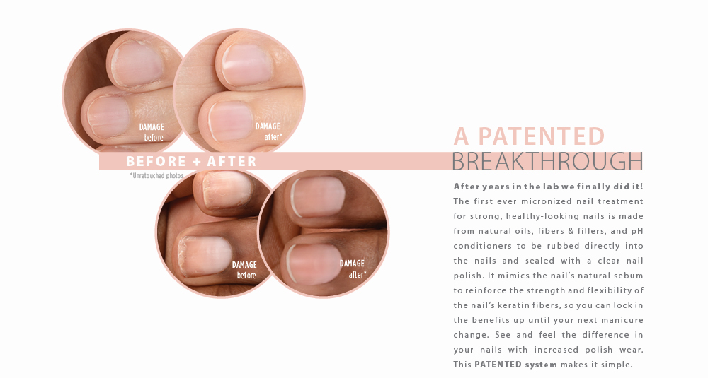 New Zoya Naked Manicure Rescue and Repair Before and After Patented System
