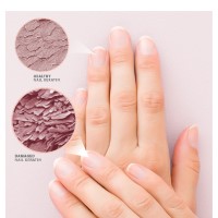 Rescue & Repair: Save My Nails Kit