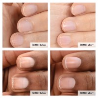 Rescue & Repair: Save My Nails Kit