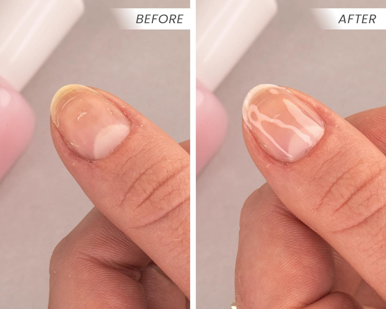 Before & After G