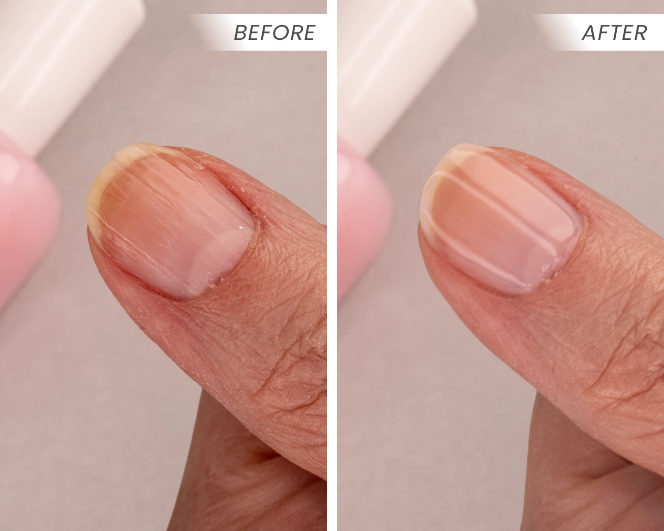 Before & After R
