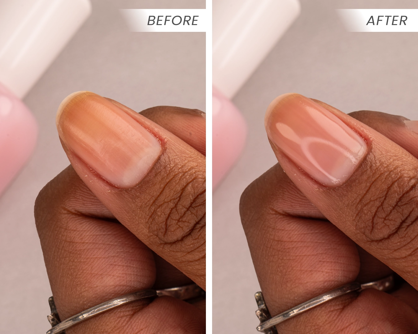 Before & After C
