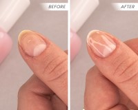 2Pure Perfector Before & After 1