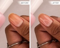 Pure Perfector Before & After 3